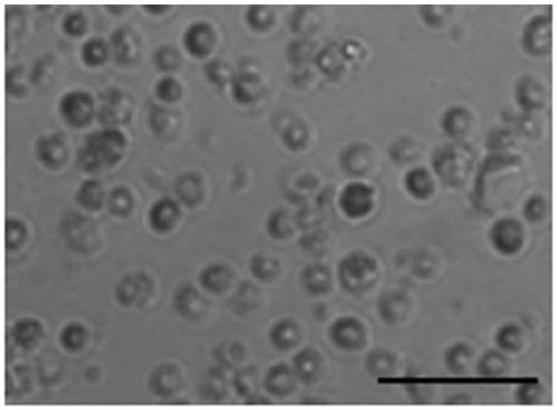 Preparation method, kit and application of hematogenous female autologous germline stem cells