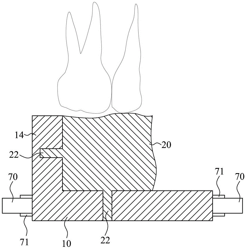 Positioning measuring device for orthodontic implant surgery