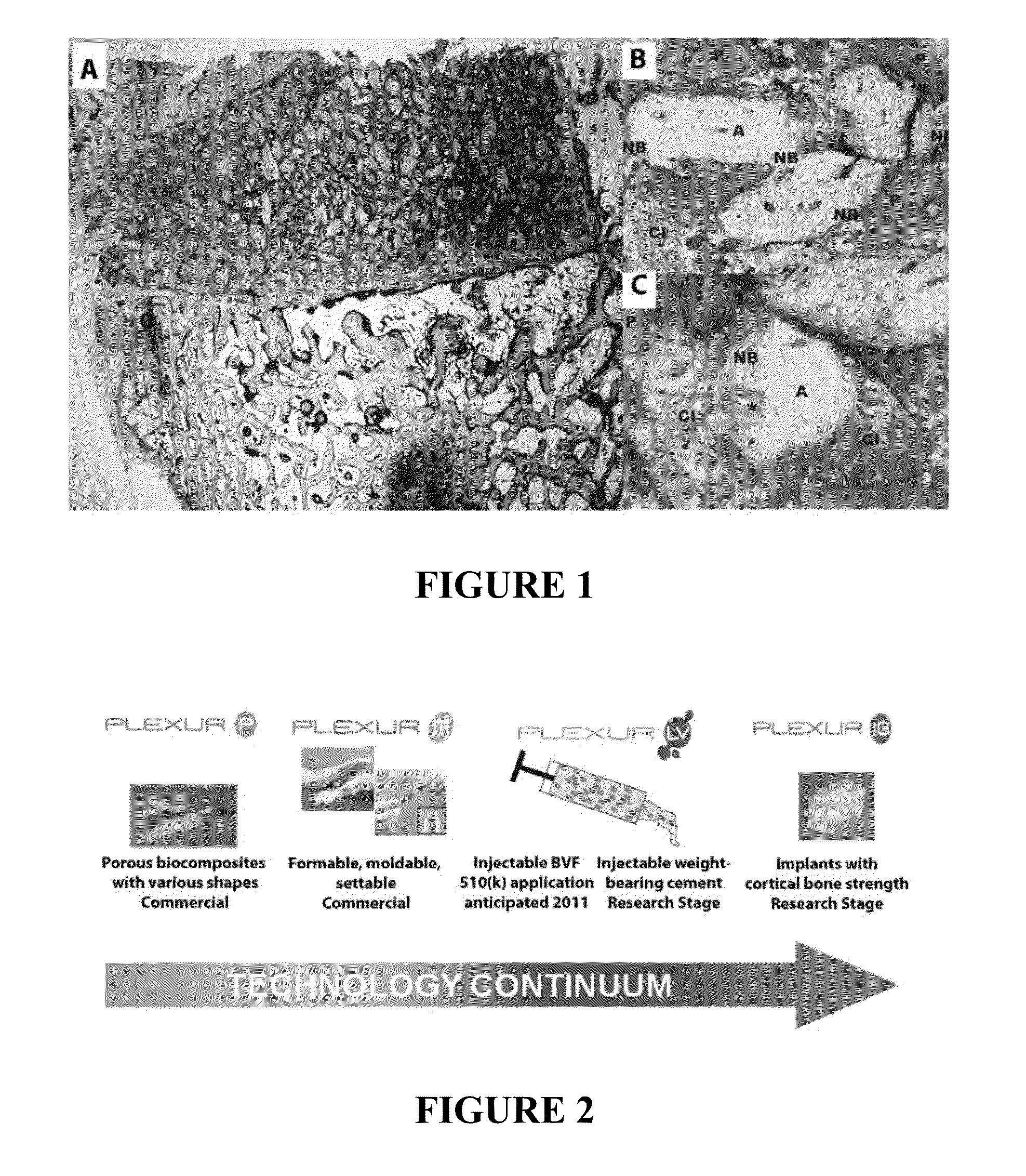 INJECTABLE ALLOGRAFT PUR COMPOSITE CARRYING rhBMP2