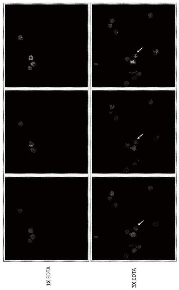 Methods and compositions for reversing platelet aggregation