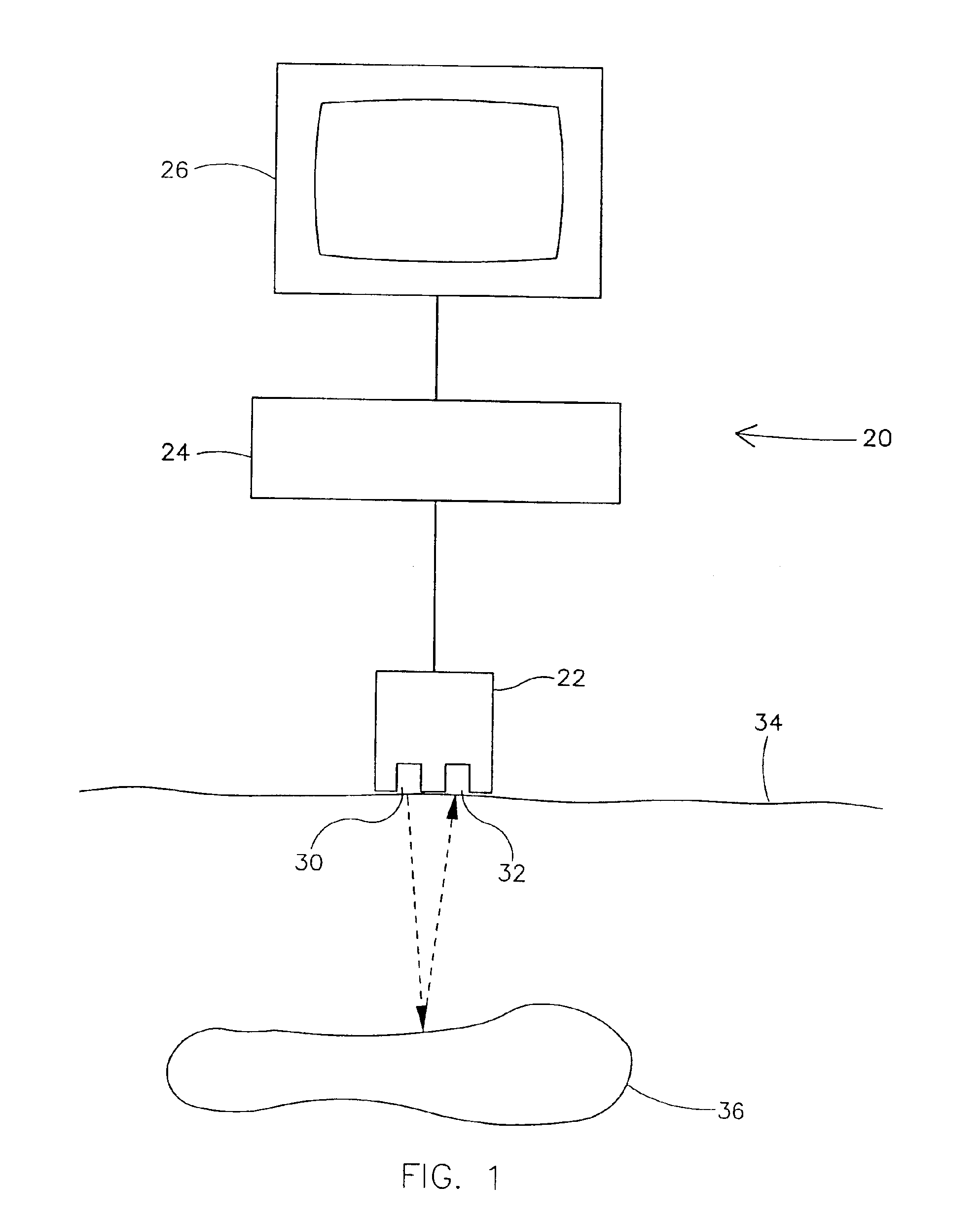 Method and apparatus for ultrasonic imaging