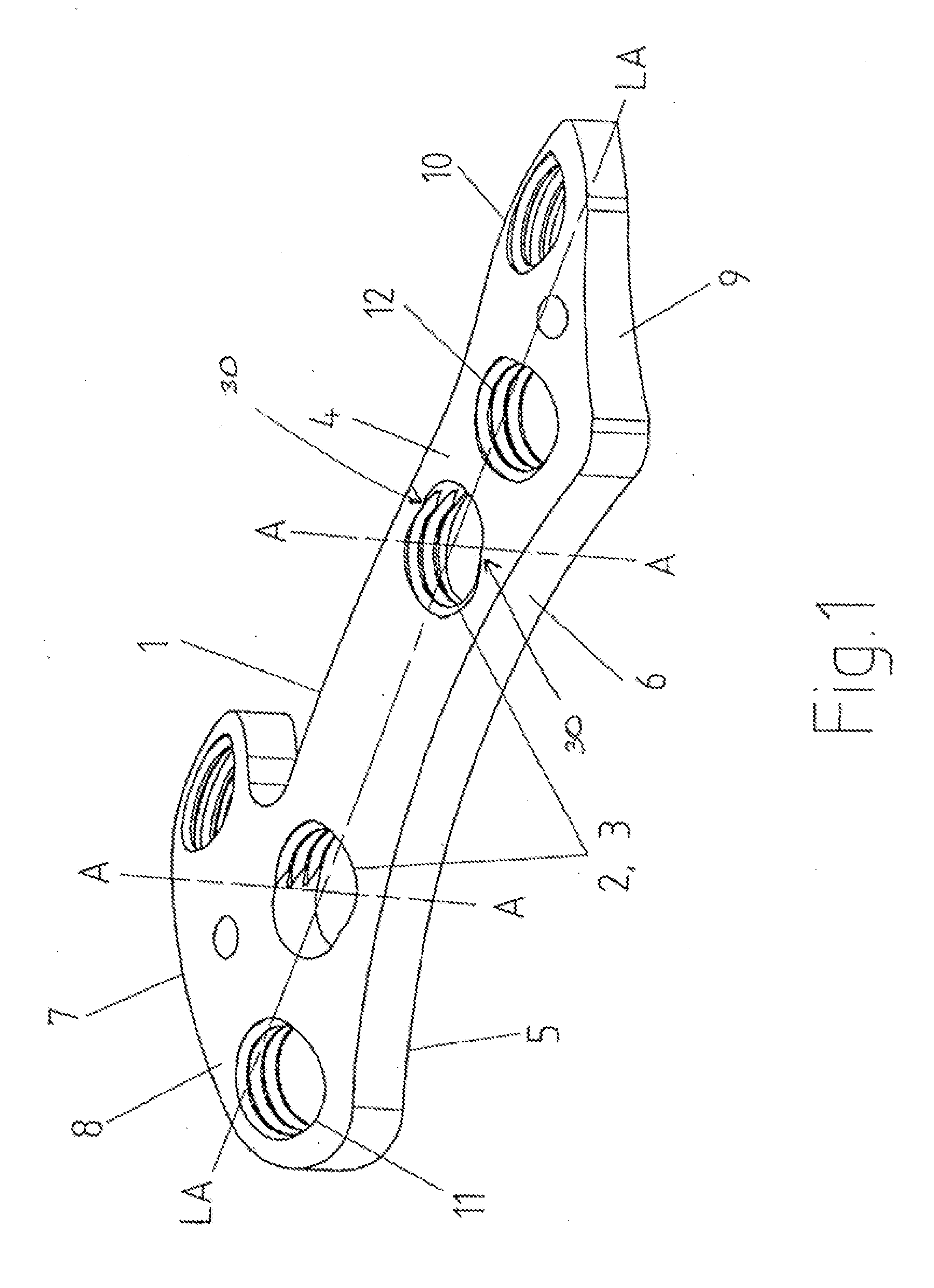 Apparatus for the Constant-Angle Fixation and Compression of a Fracture or Osteotomy of a Bone