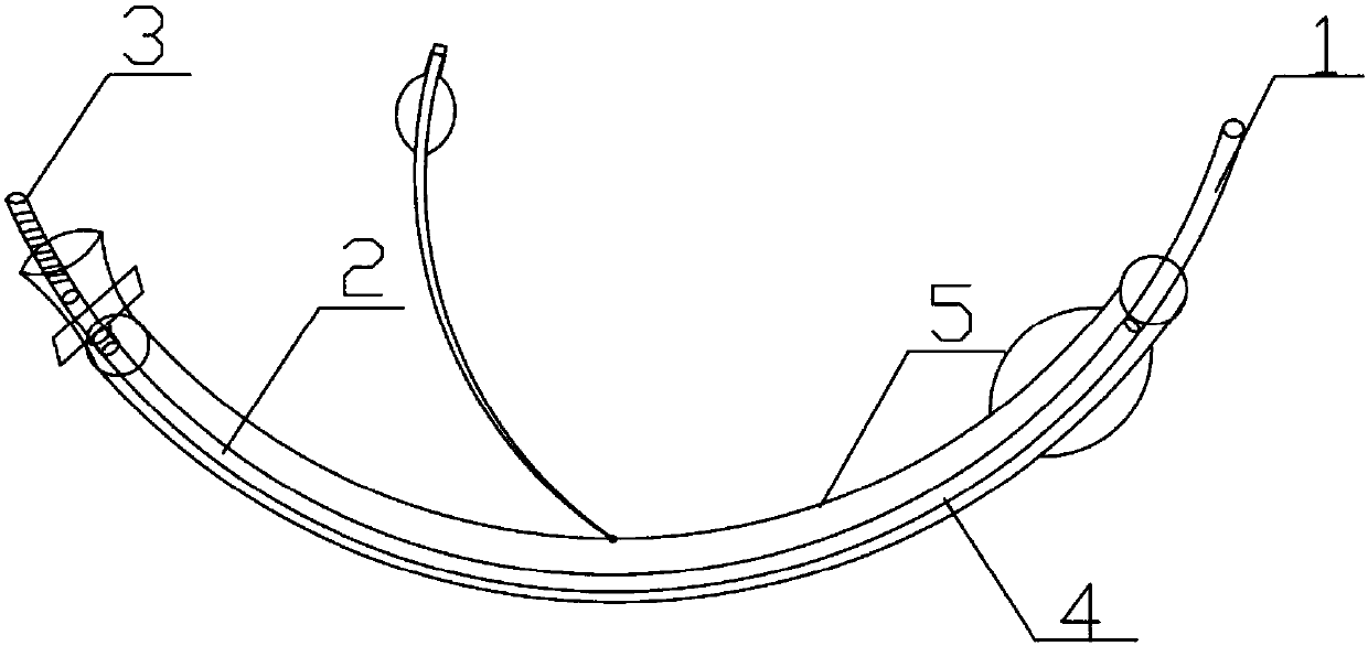 Trachea cannula core and preparation method thereof