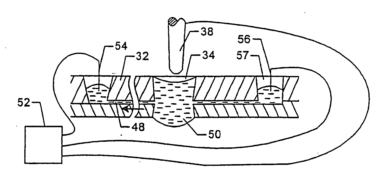 Microfabricated structures for facilitating fluid introduction into microfluidic devices