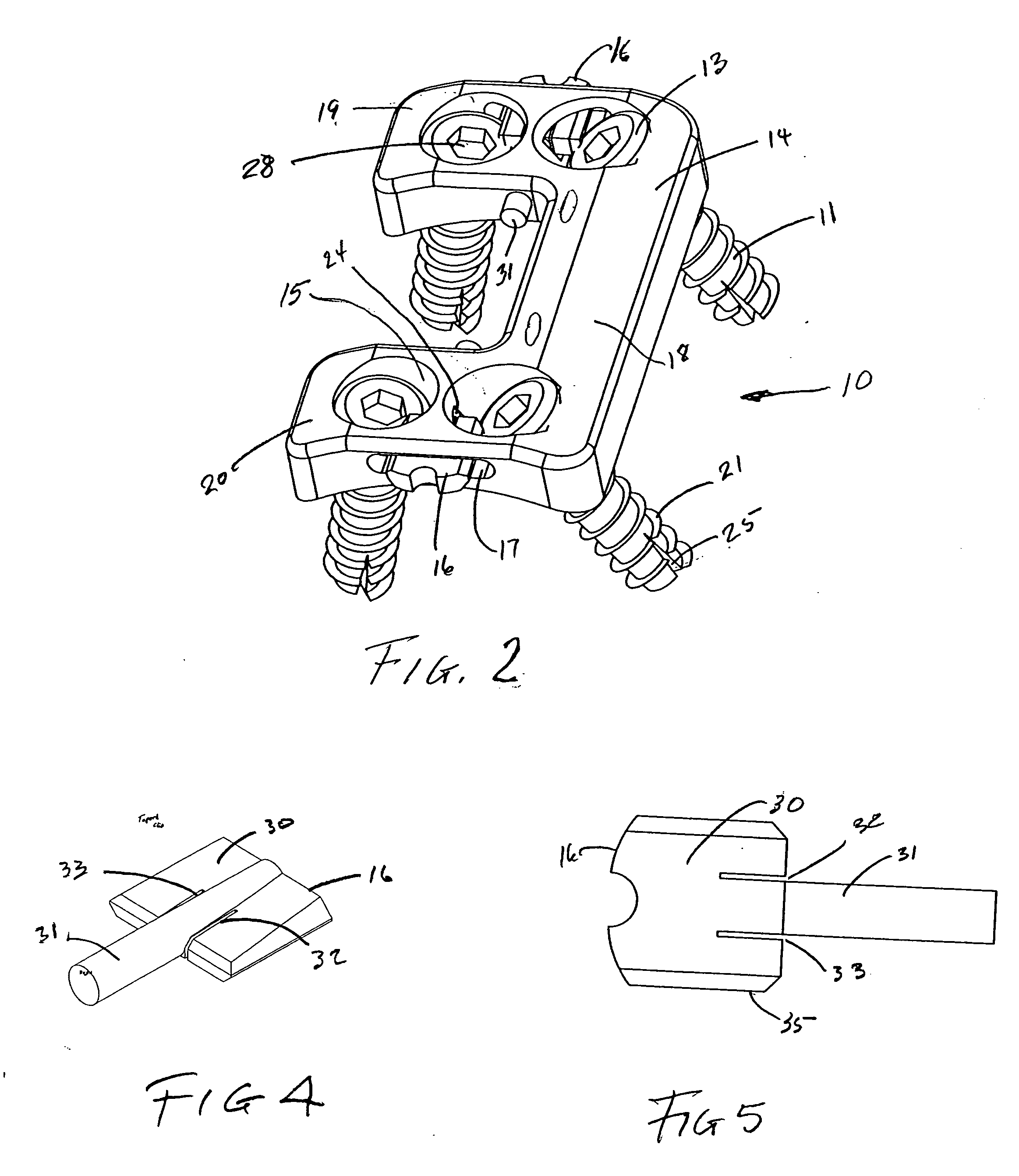 Static anterior cervical plate