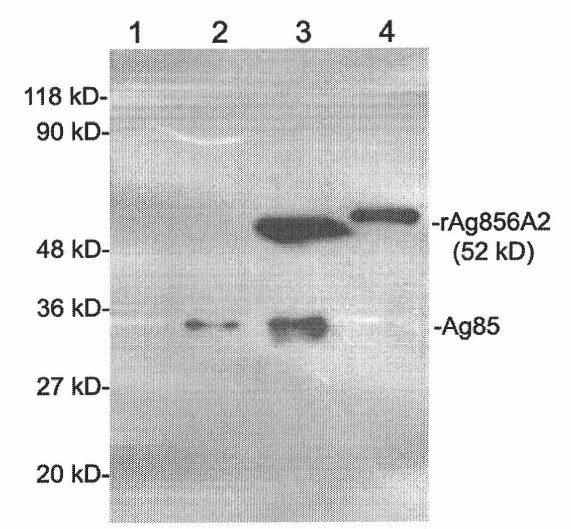 Reinforced mosaic gene recombinant bacillus calmette-guerin and preparation method thereof