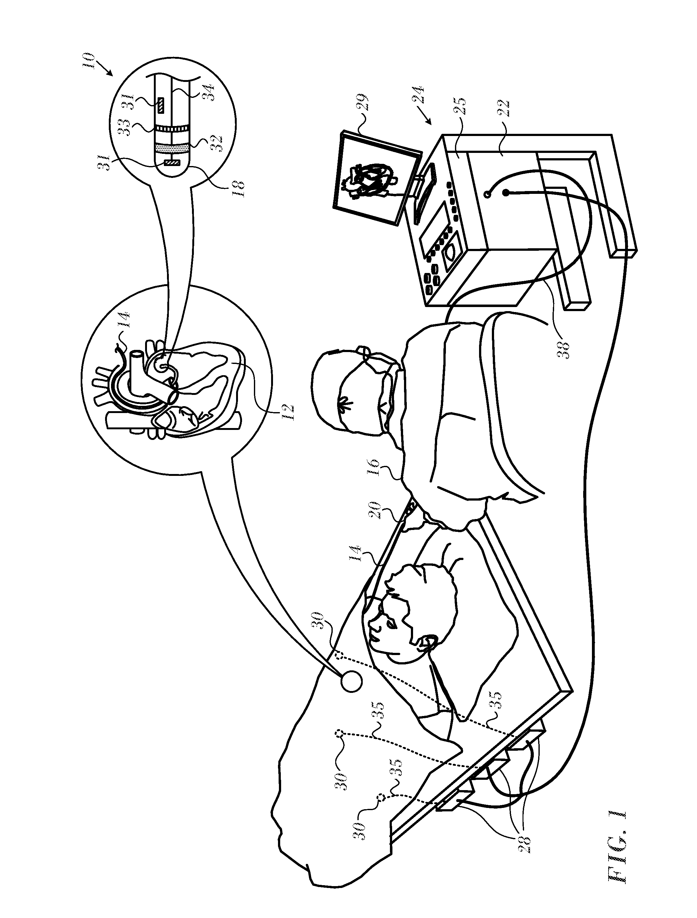 Ventricular electrical activity indicator