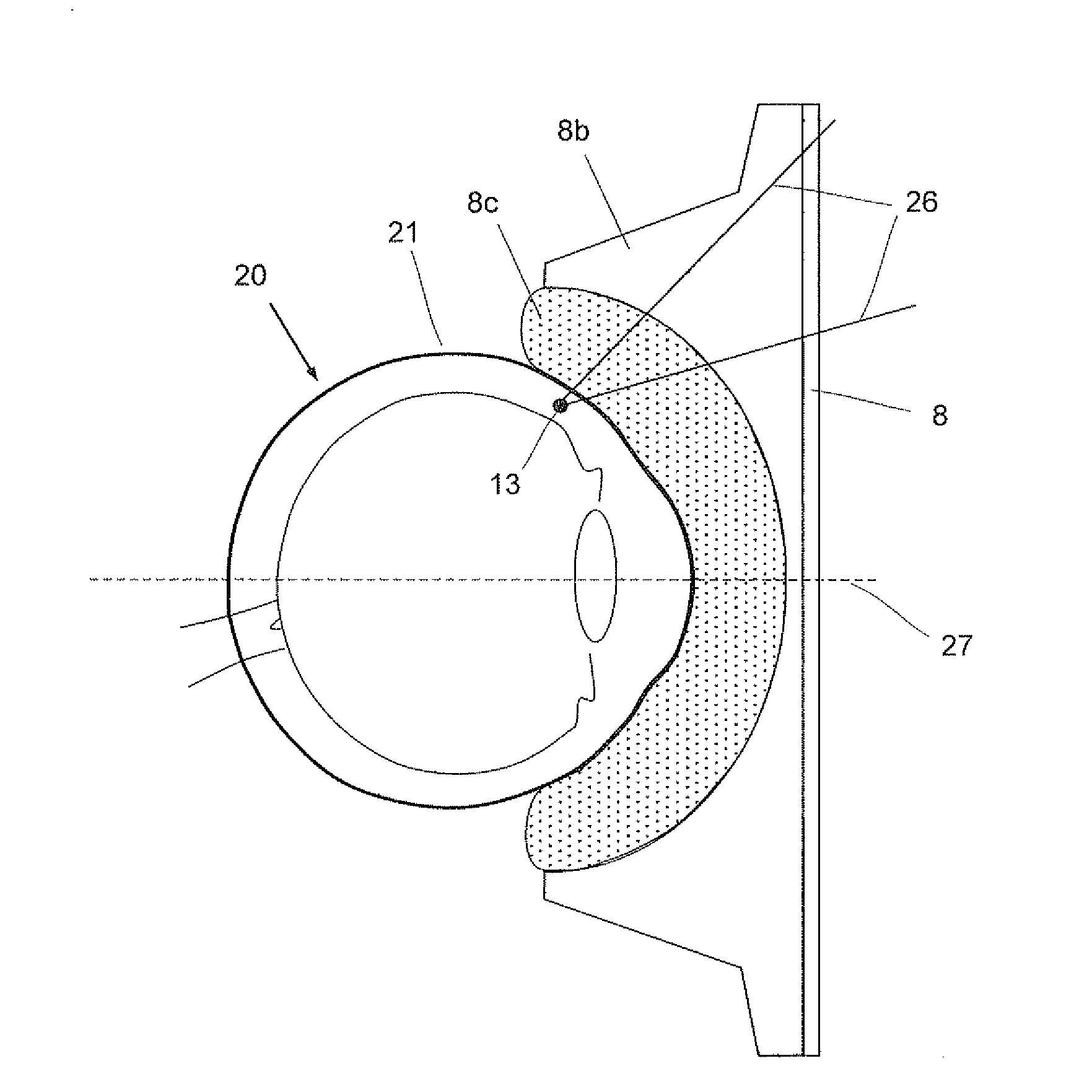 Laser therapy system and method for treatment of a collagen structure and of varicose blood vessels in an eye