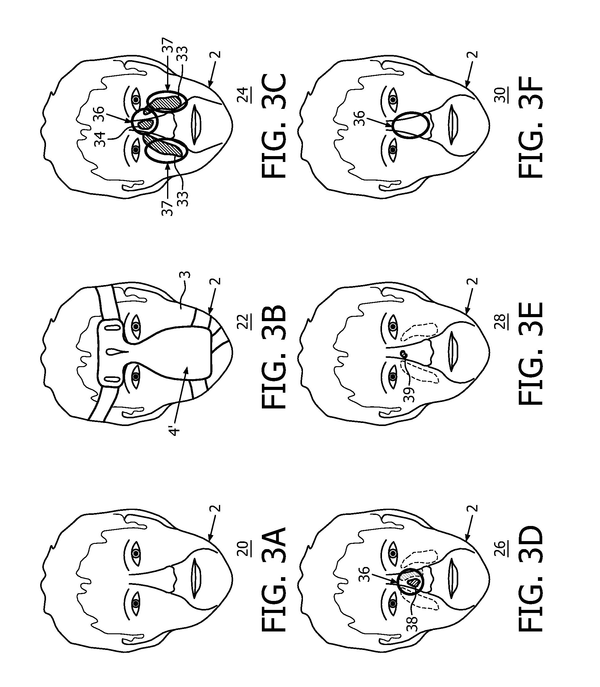 Mask comfort diagnostic method