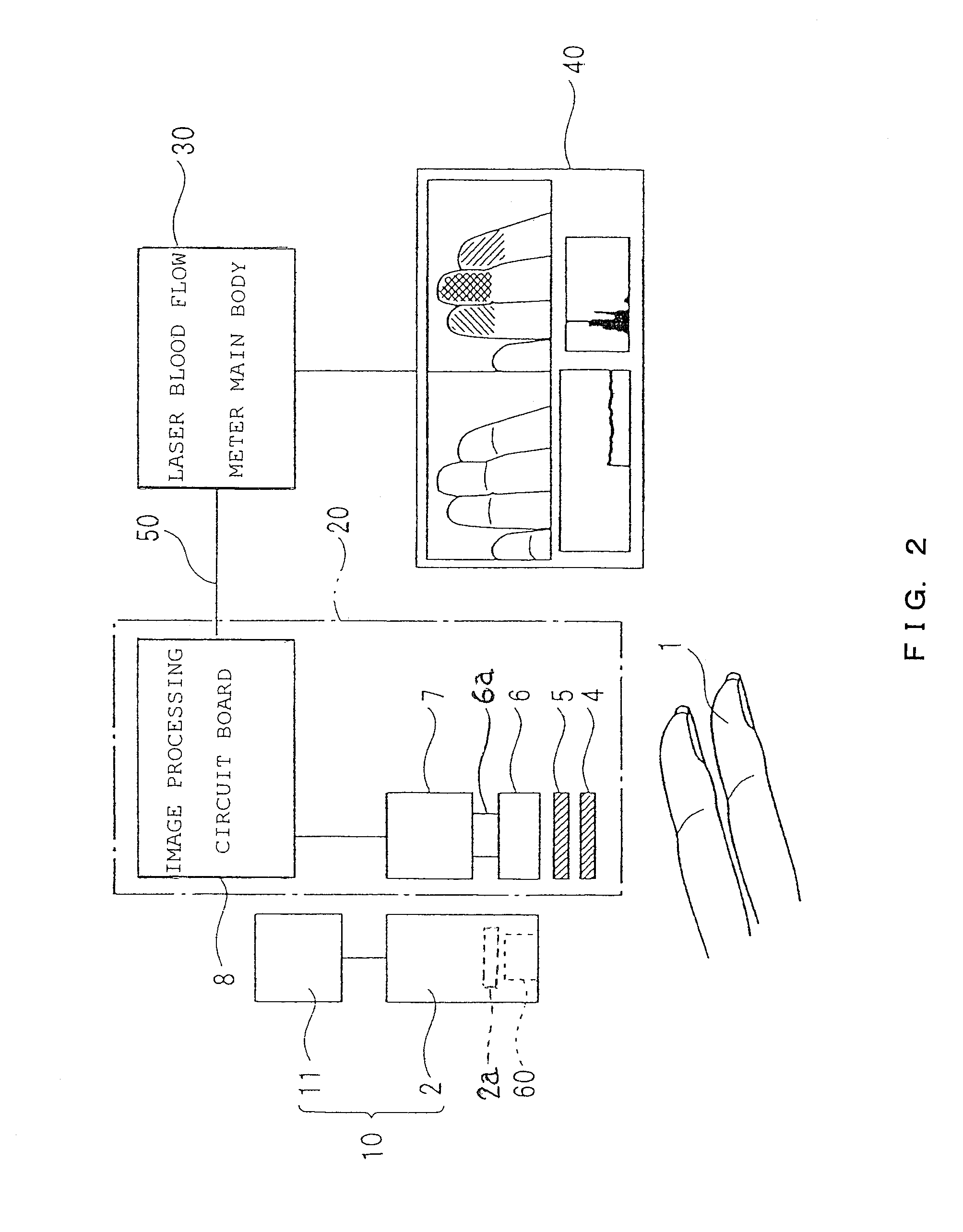 Laser blood flow imaging apparatus