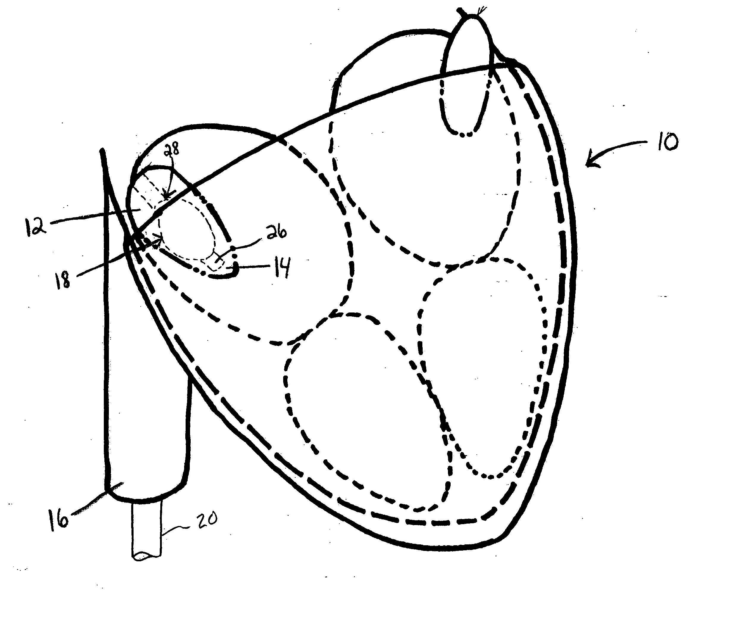 Devices and methods for access through a tissue wall