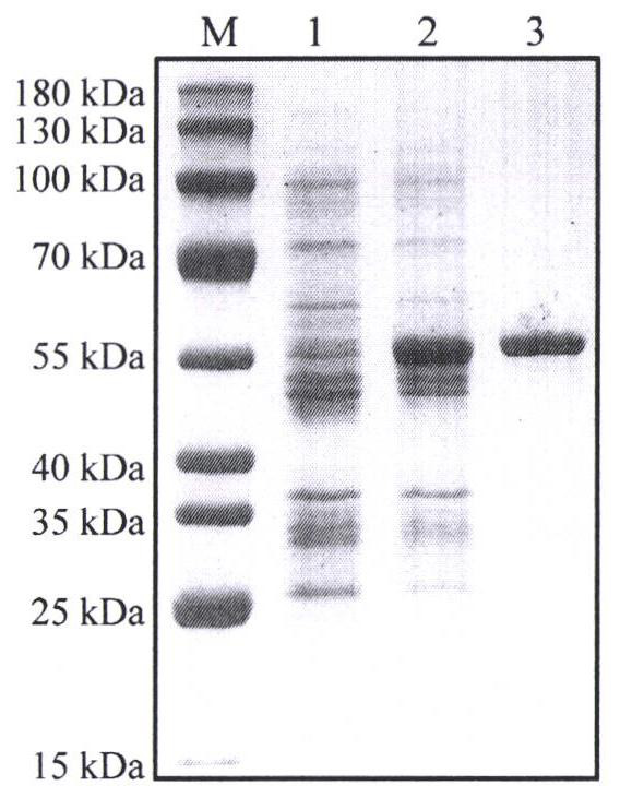 Preparation method of cryptocaryon irritans vaccine based on tetrahymena thermophila tubulin protein