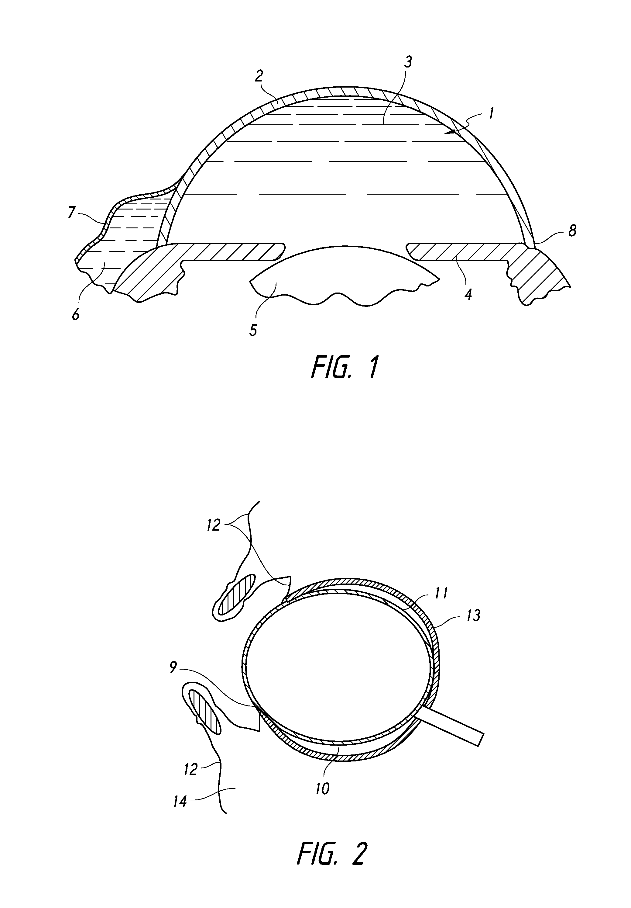 Intraocular devices