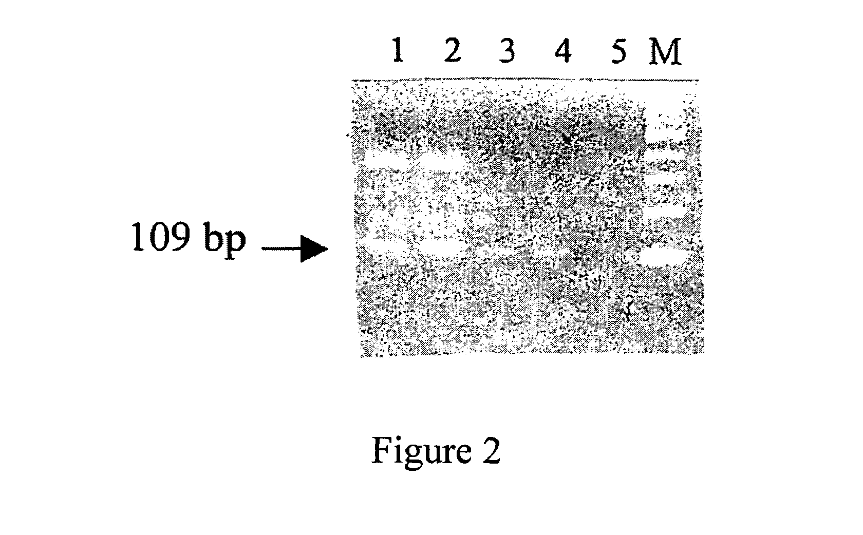 Helicobacter pylori antigens in blood