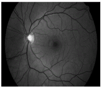 Level set retinal vessel image segmentation method with shape prior being fused