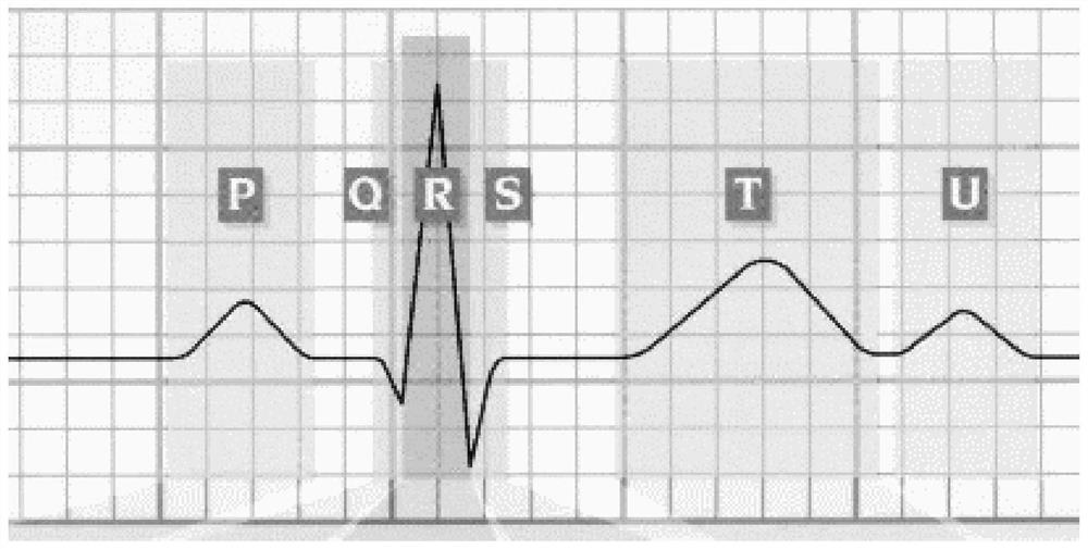 Atrial fibrillation detection device and storage medium