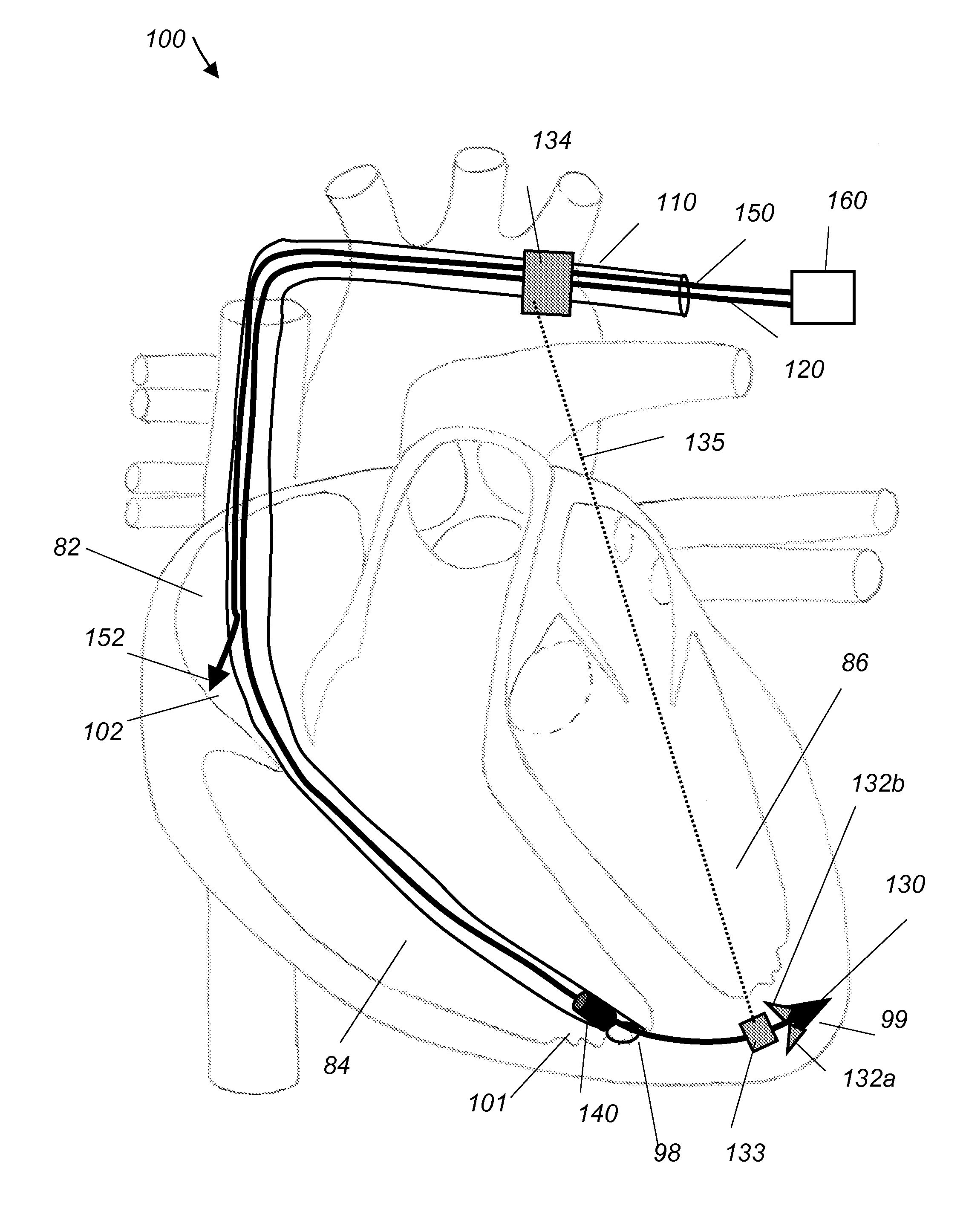 Multifunctional cardiac pacemaker system