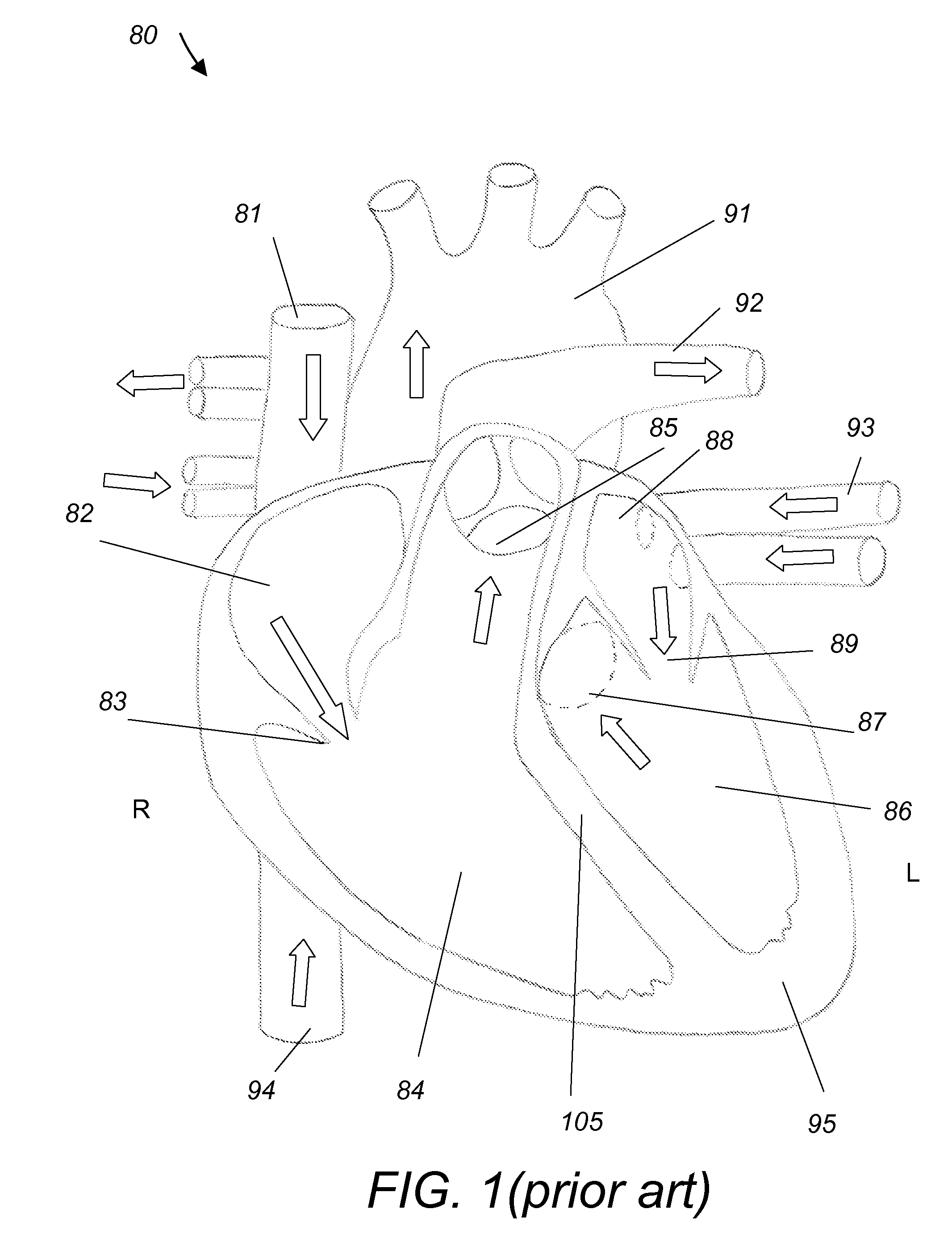 Multifunctional cardiac pacemaker system