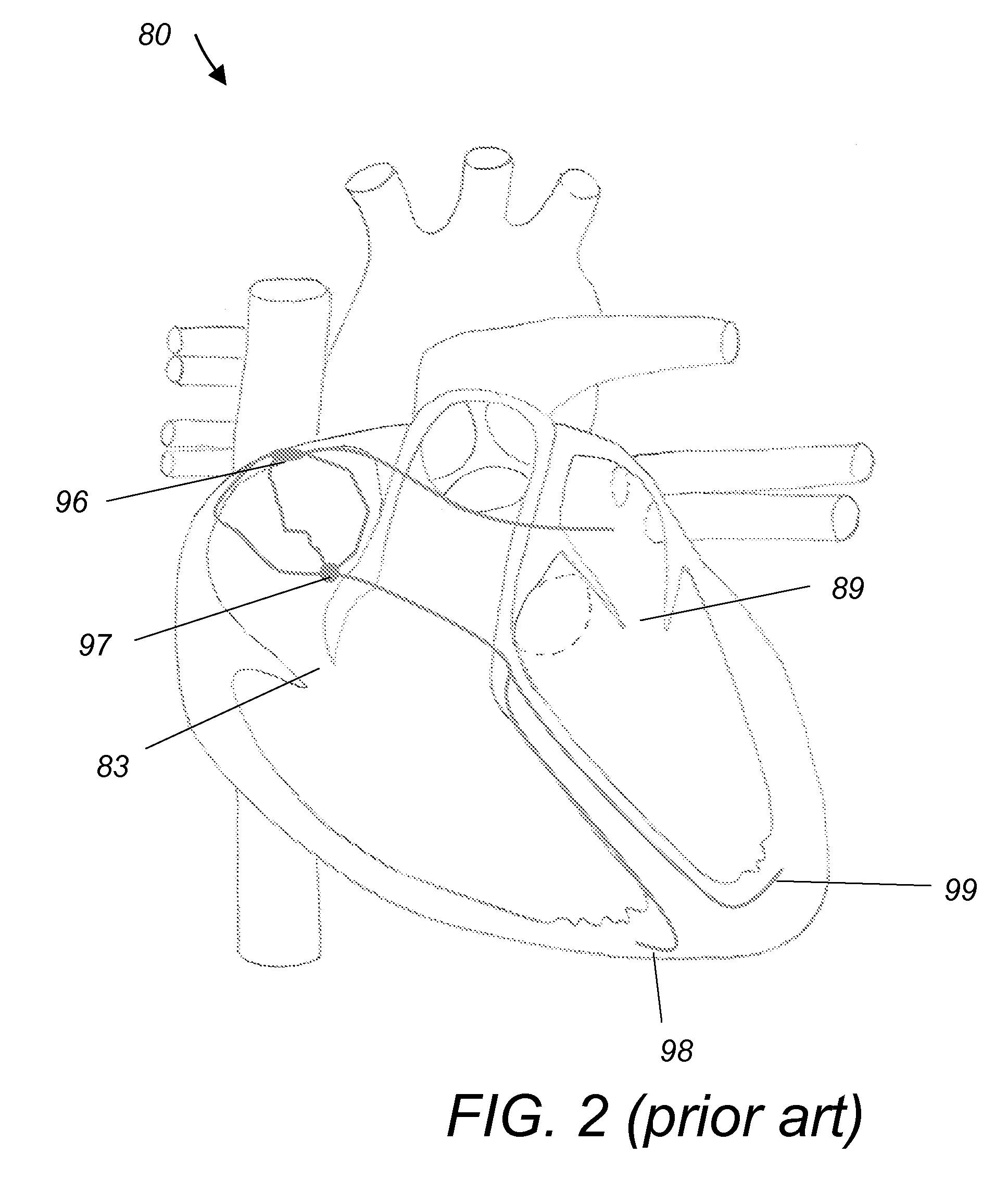 Multifunctional cardiac pacemaker system