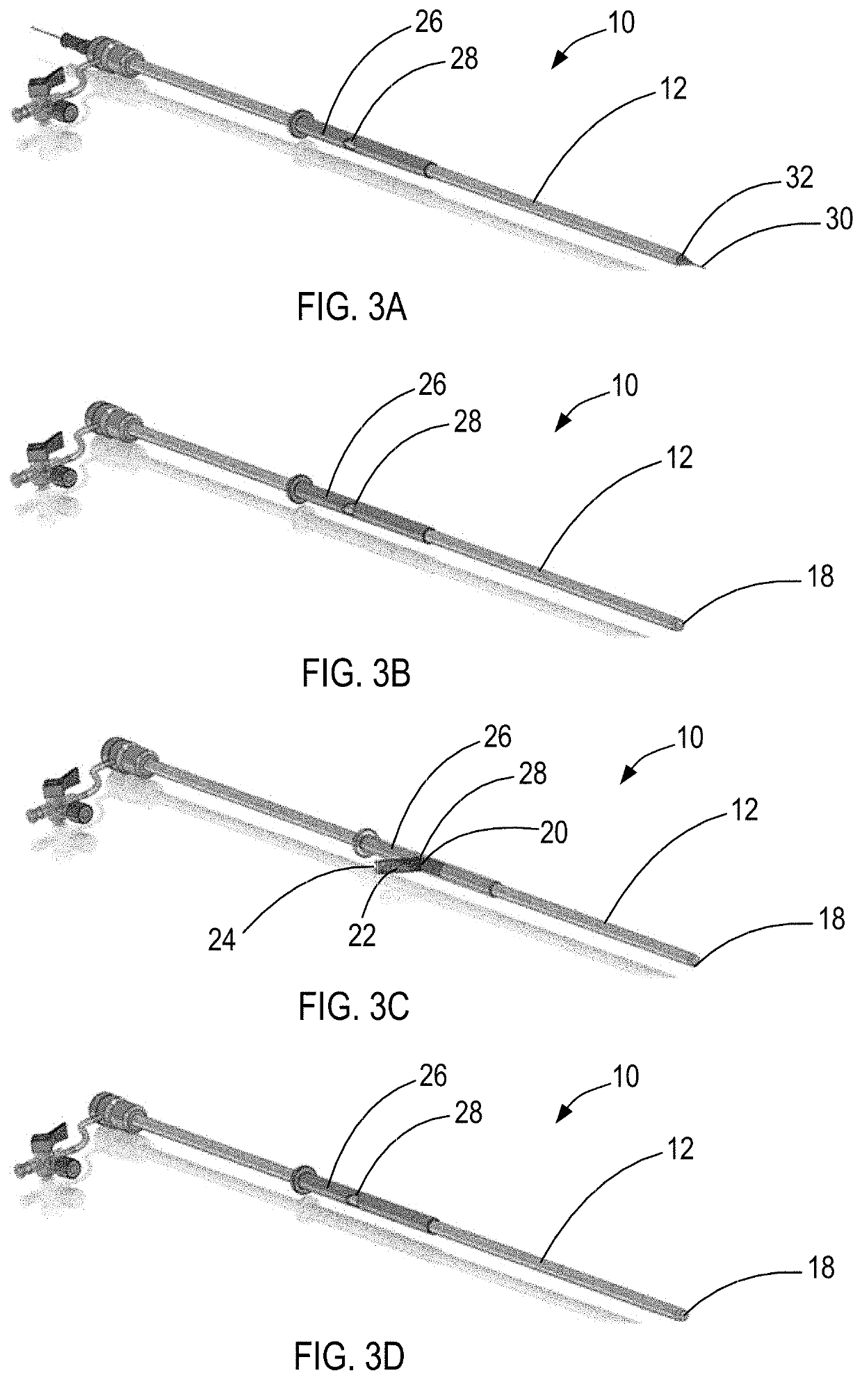 Systems and methods for diverting blood flow in blood vessels