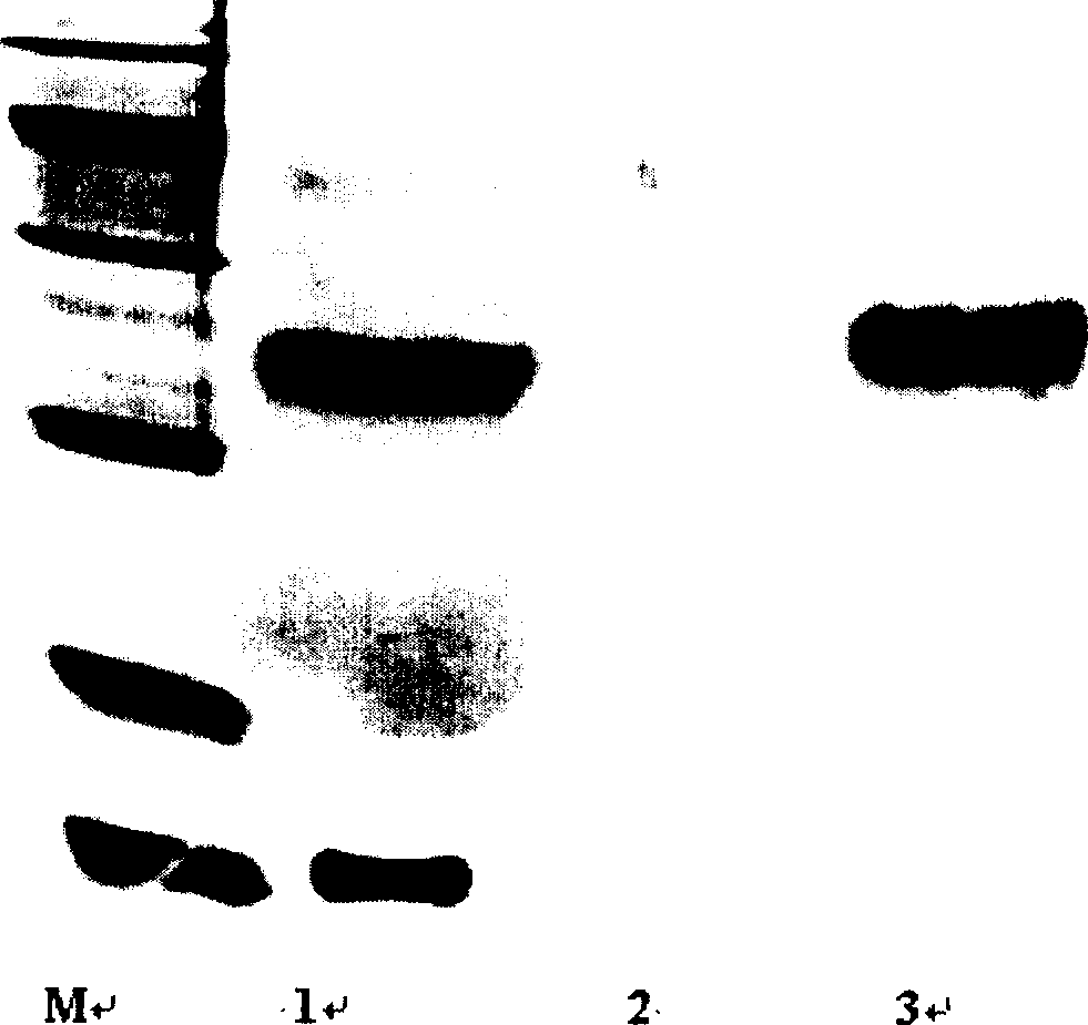 Polyethylene glycol modified and recombined human interleukin and its preparation method