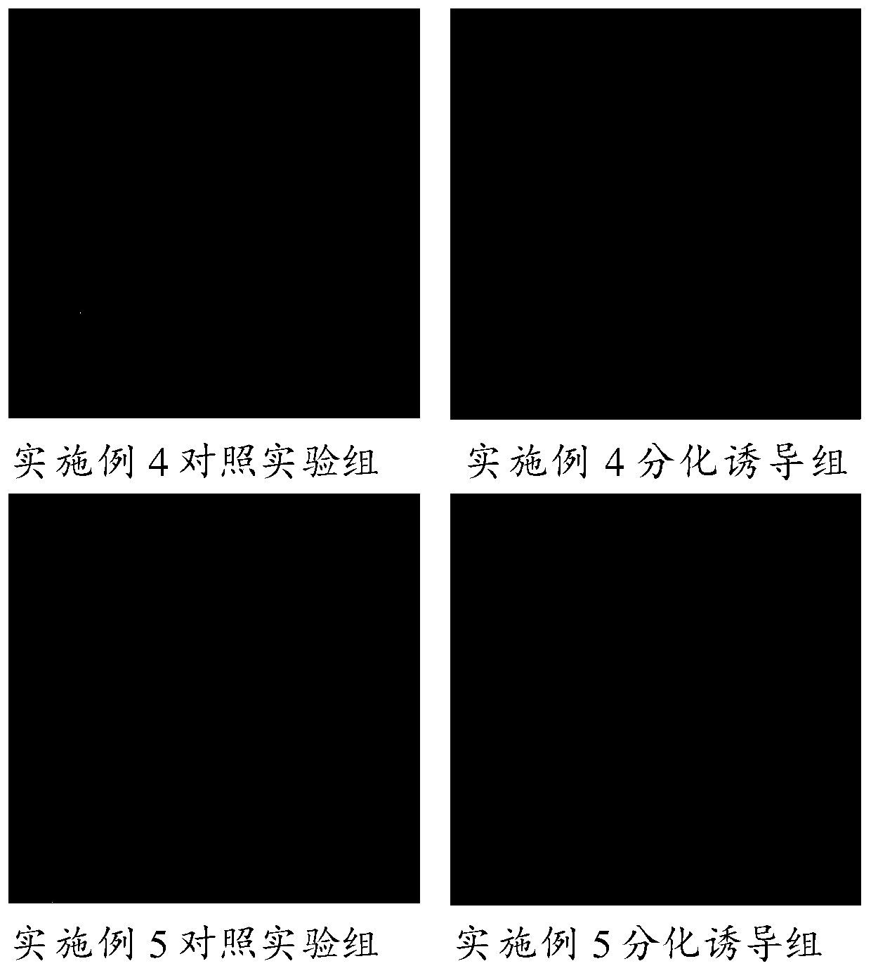 Culture medium for inducing differentiation of dental pulp stem cells into osteoblasts, and preparation method and application of culture midium