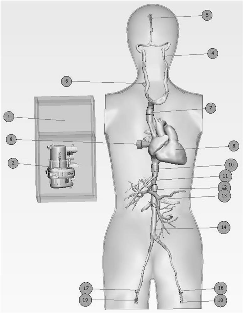 TIPSS interventional therapy training device