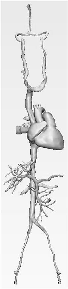 TIPSS interventional therapy training device