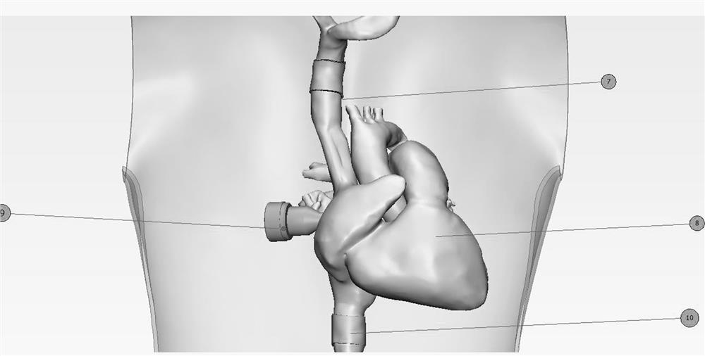 TIPSS interventional therapy training device