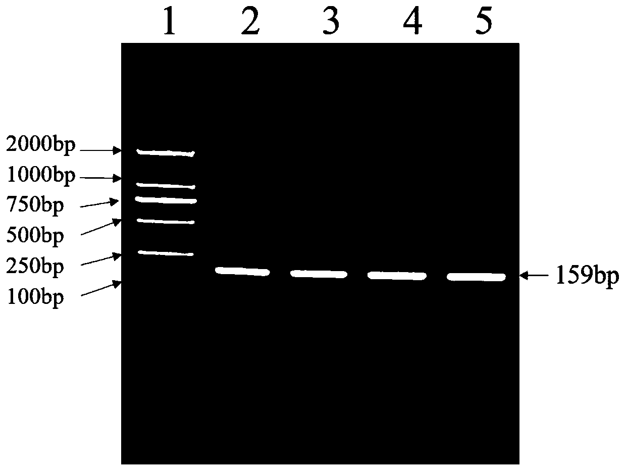 Method for detecting single nucleotide polymorphism of sheep DAQL gene by using PCR-RFLP and application of method