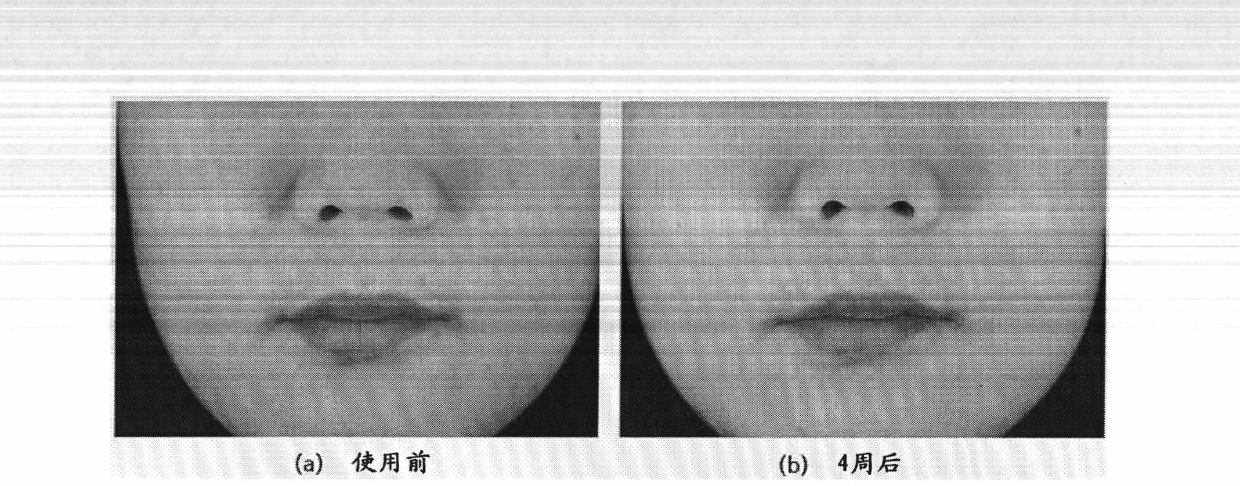 Cosmetic composition for improving skin tone or skin elasticity