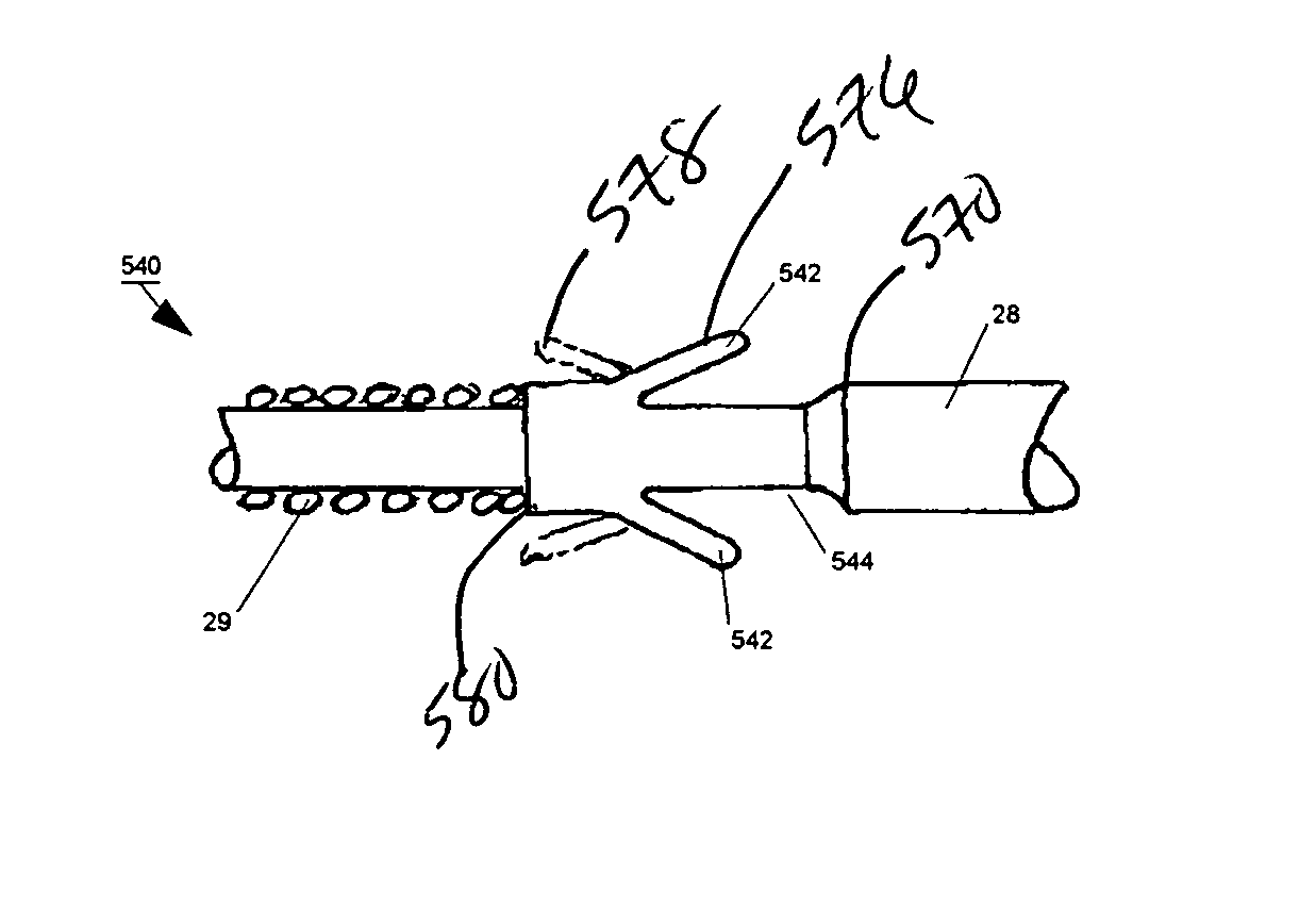 Subcutaneous lead fixation mechanisms