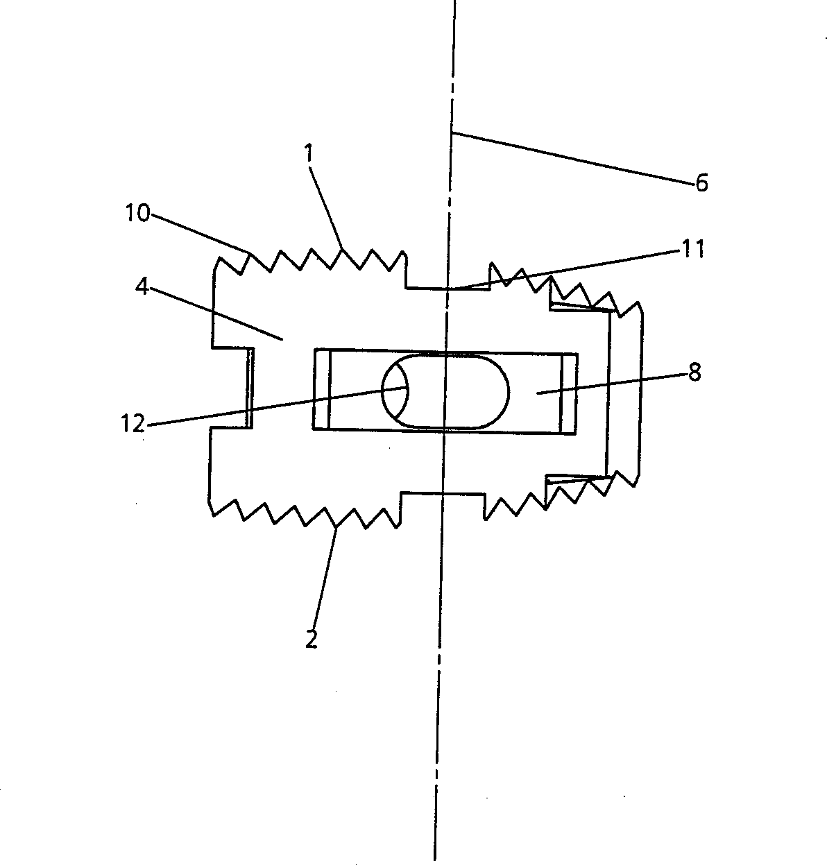 Intervertebral implant