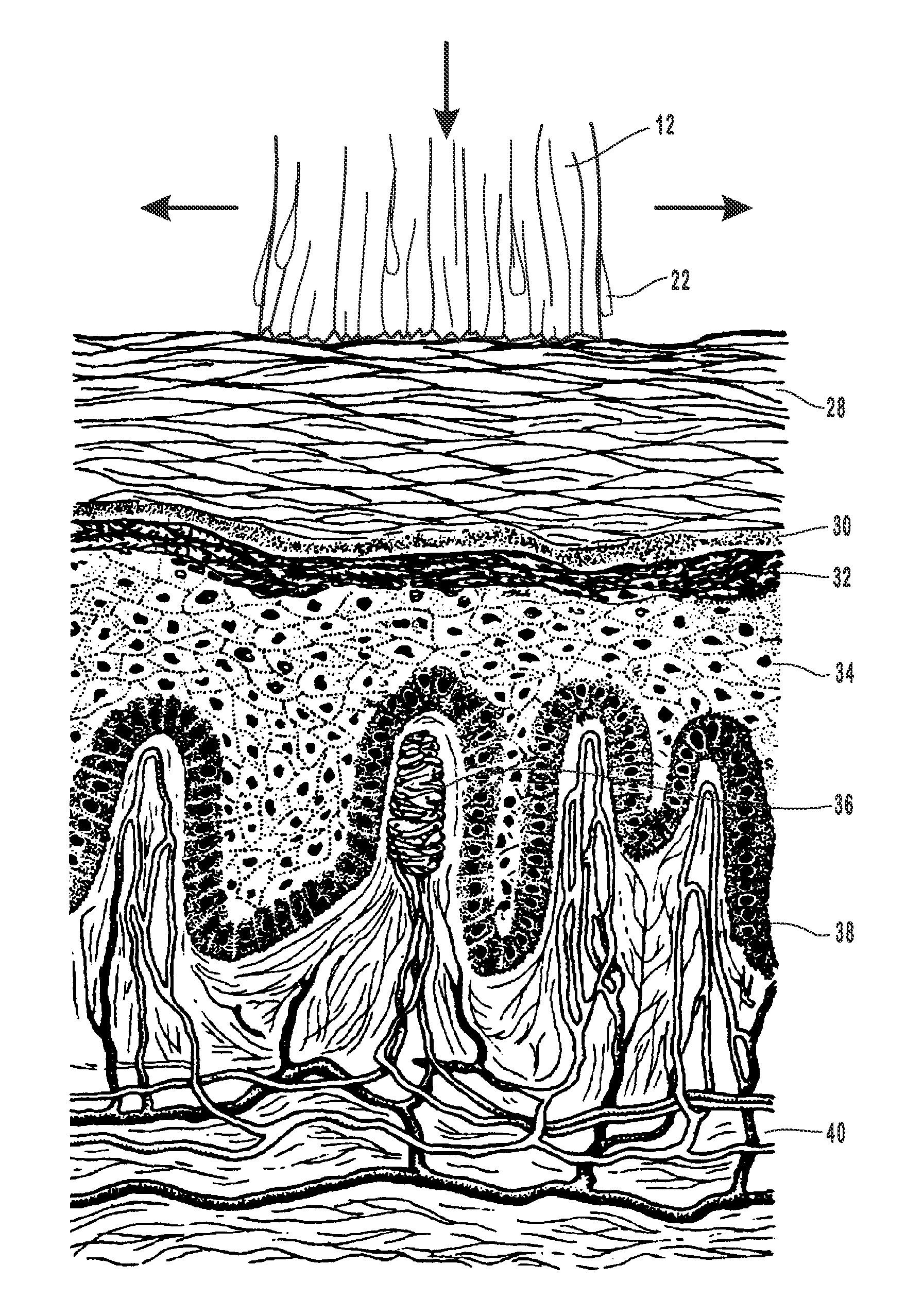 Combined systemic and topical treatment of disordered and/or prodromal stage tissue