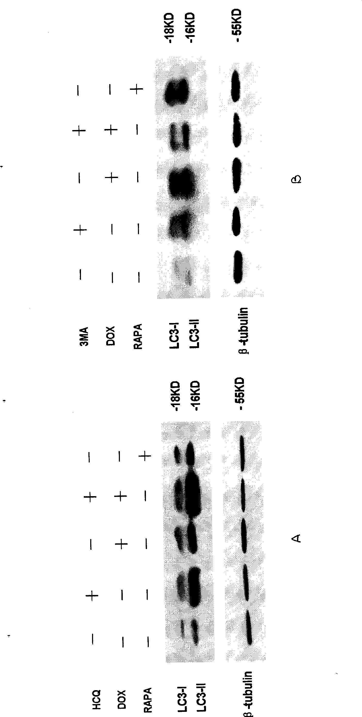 New use of anti-impaludism medicament hydroxyl chloroquine