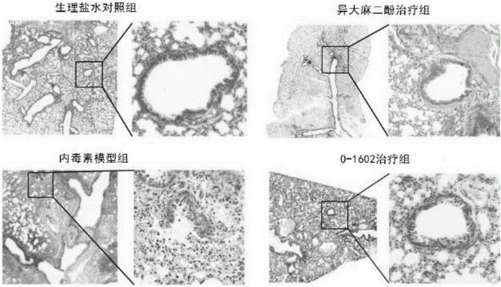 Application of G protein coupling receptor 18 agonist in preparation of infection drugs