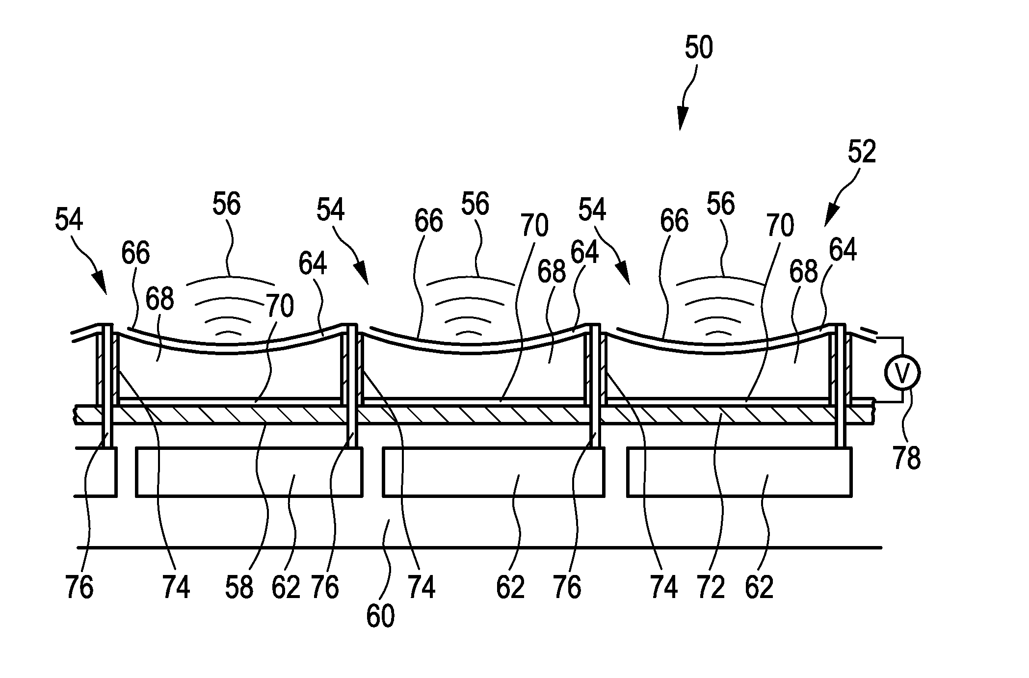 Ultrasound transducer assembly