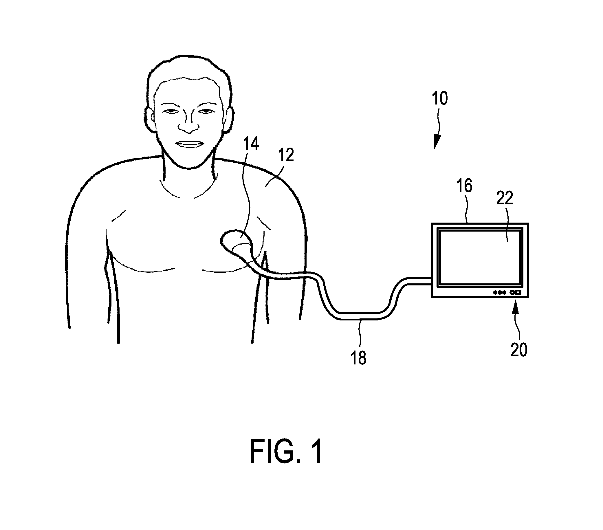 Ultrasound transducer assembly