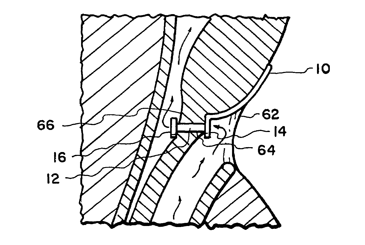 Medical devices having antimicrobial properties