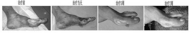 Preparation method and application of stem cell extract