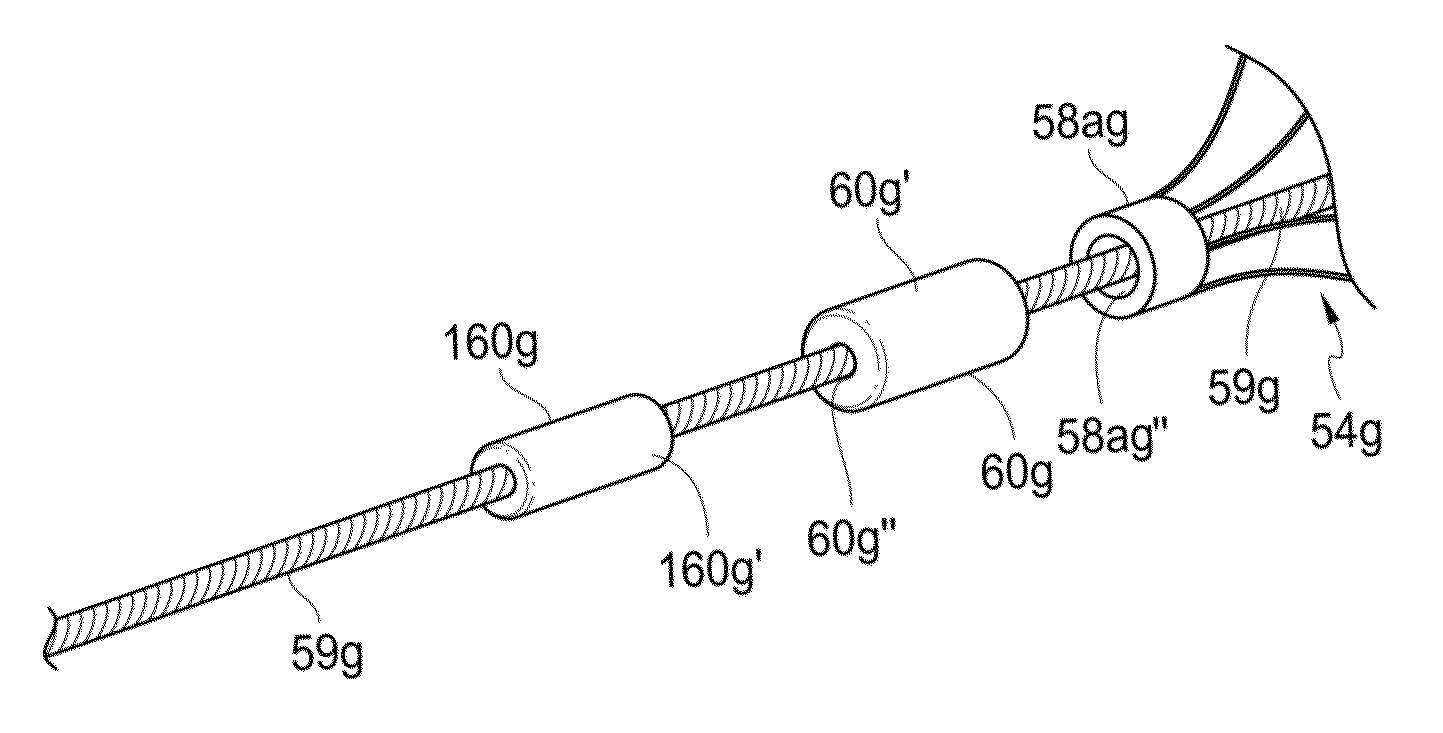 Methods and apparatus for luminal stenting