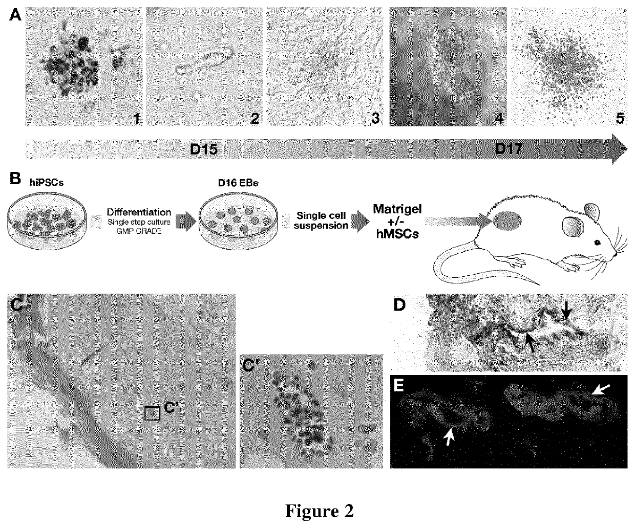 Methods of improving hematopoietic grafts