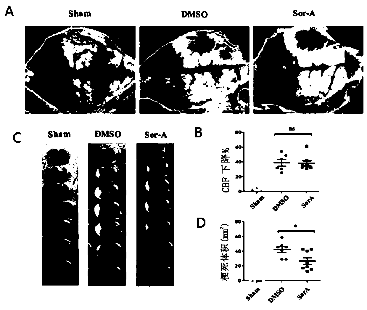 Application of Sorafen A in Ischemic Brain Injury