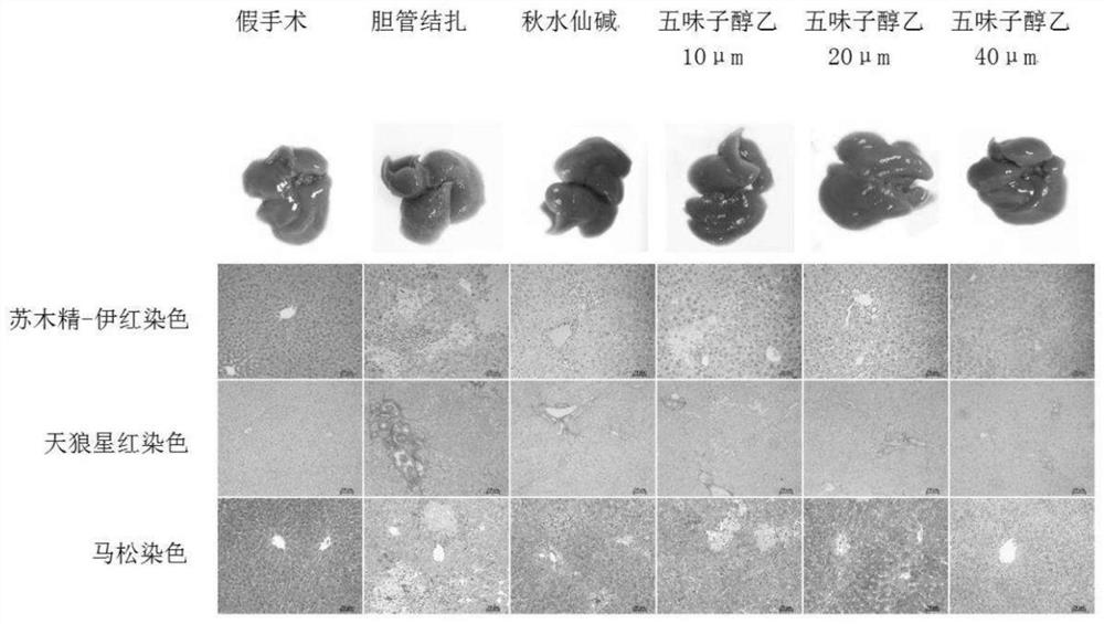 Application of combination of lignan compound and furocoumarin compound to treatment of liver fibrosis