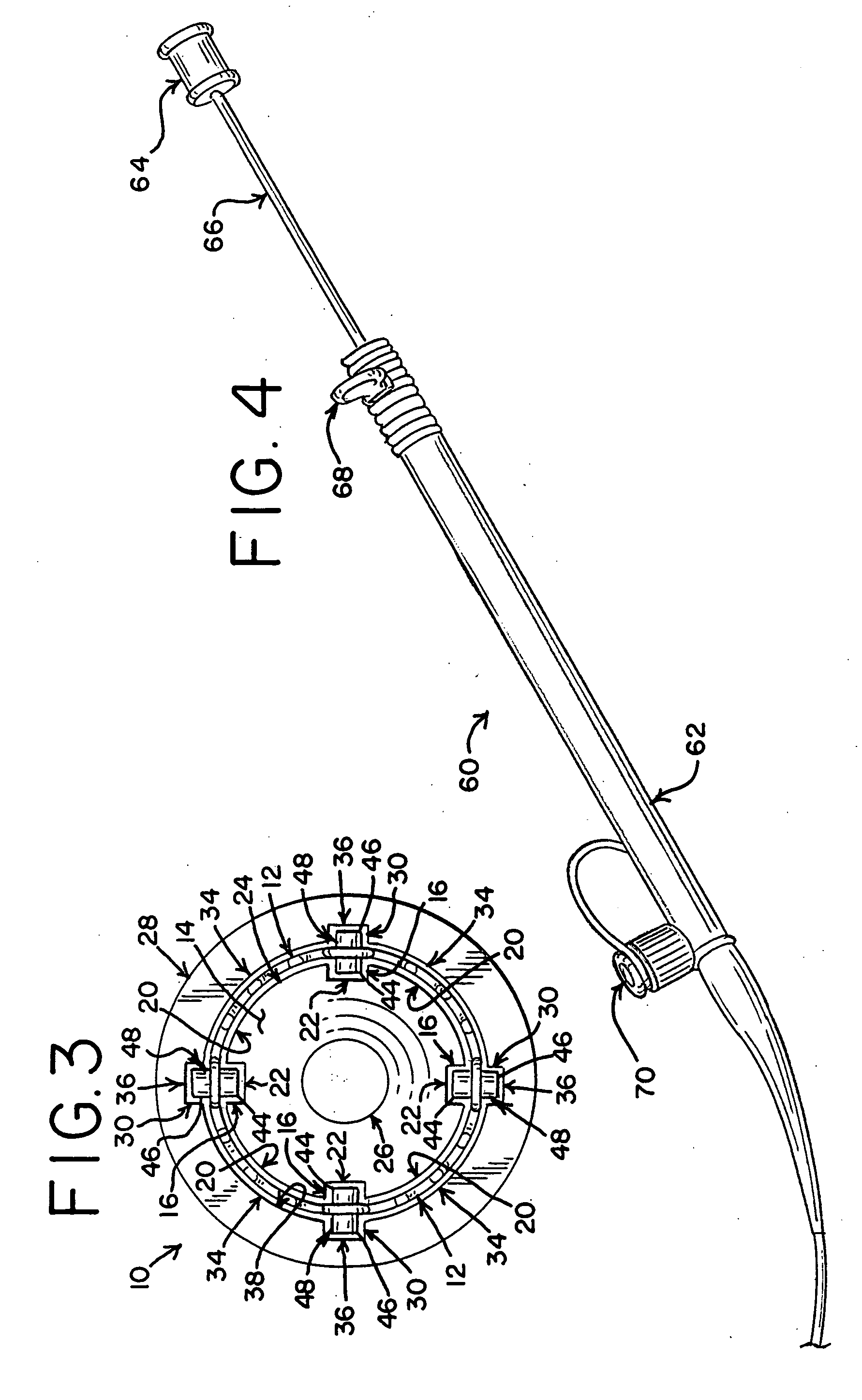 Delivery system with helical shaft