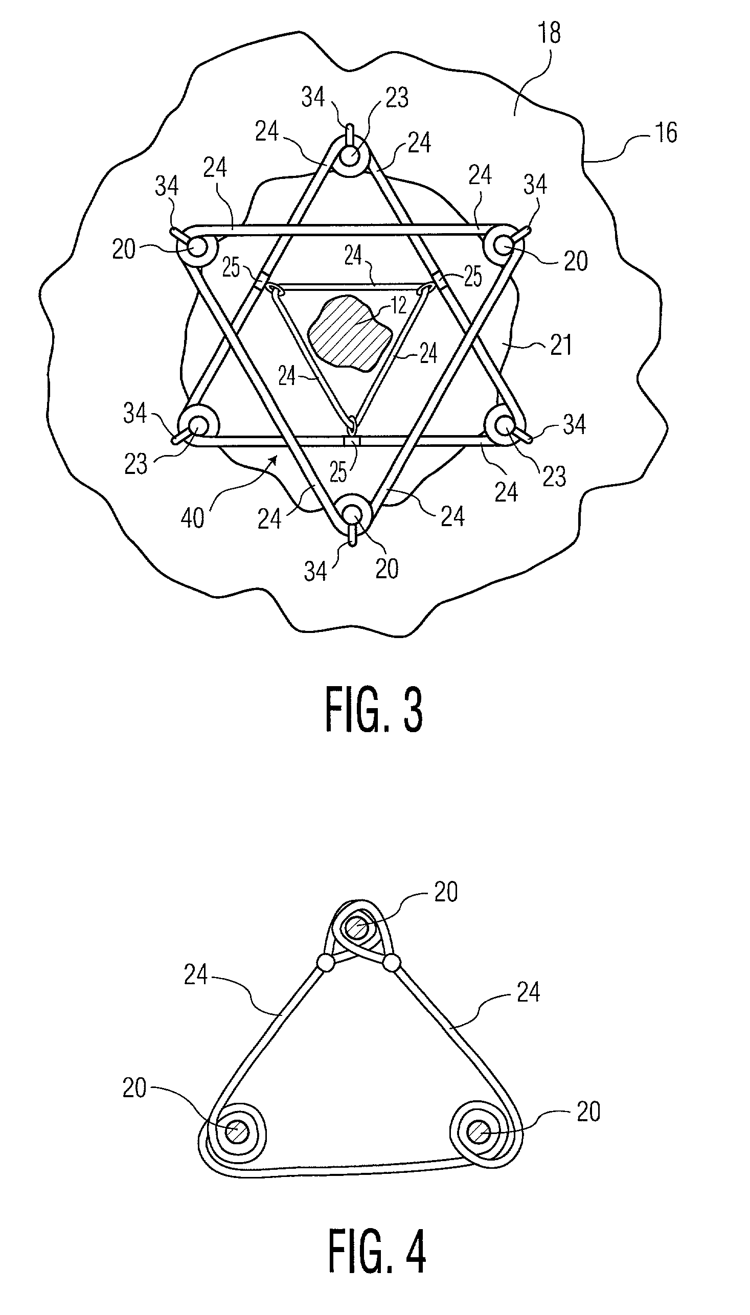 Tree and shrub stabilizing apparatus and method for stabilizing a tree or shrub