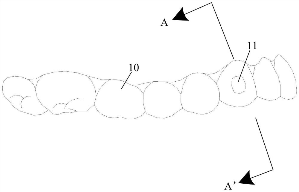 Design method and preparation method of tooth correction system