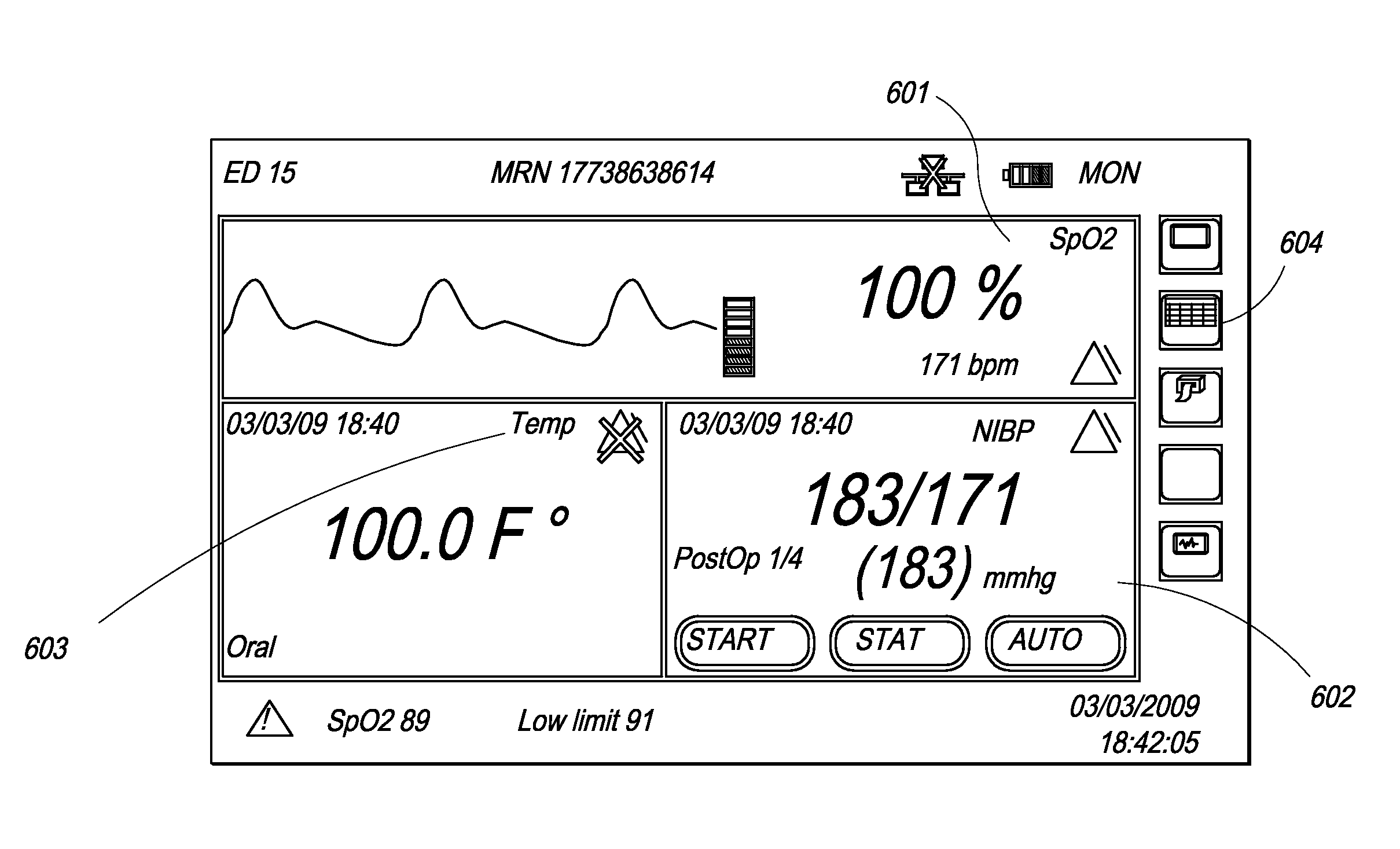 Multiple Mode, Portable Patient Monitoring System