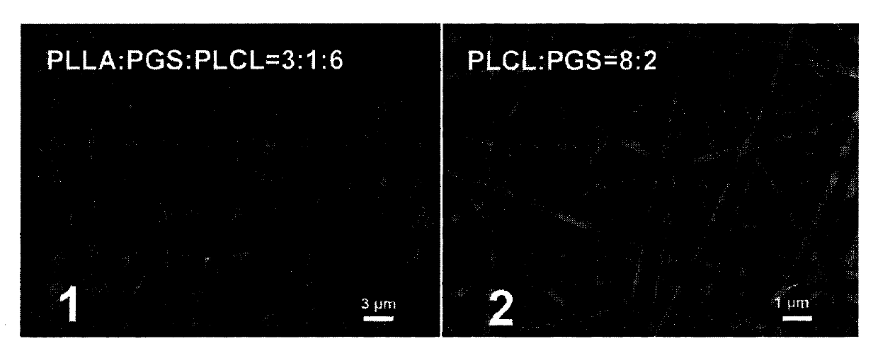 A kind of thermally induced phase separation nanofiber tubular scaffold and preparation method thereof