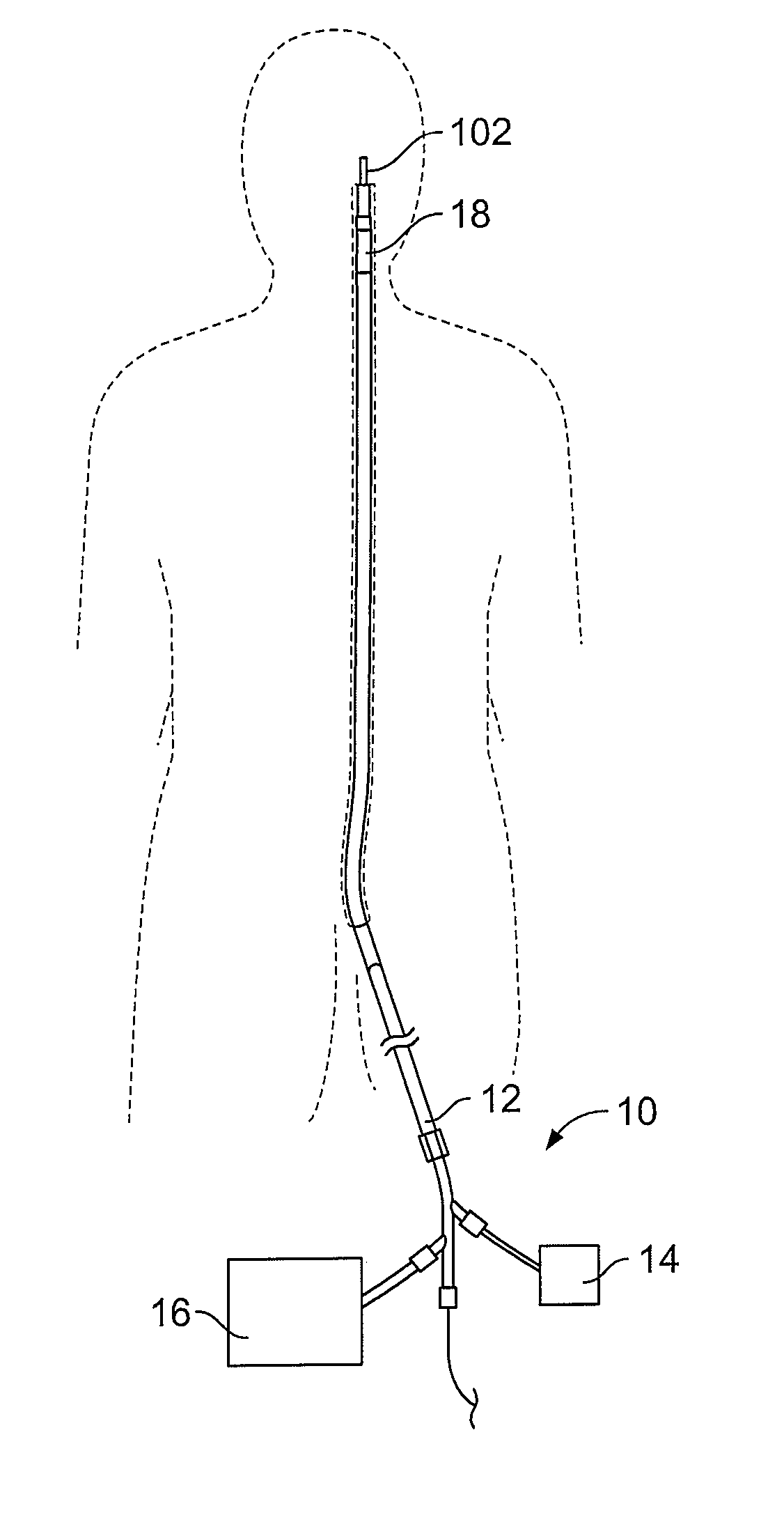 Devices for restoring blood flow within blocked vasculature